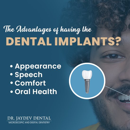 dental-implants-benefits-advantages
